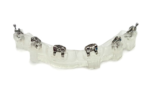 Preparing an aligner