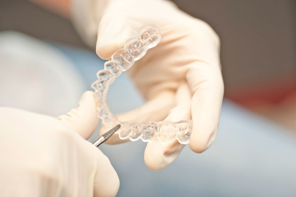 Smiling with clear aligner